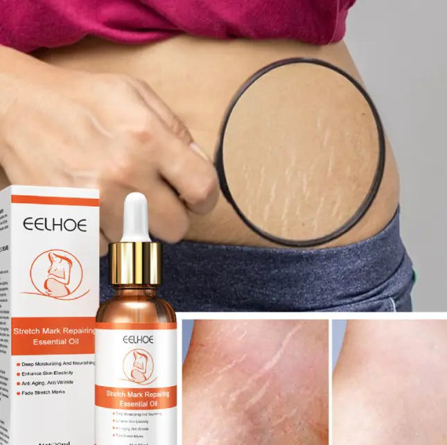 EELHOE Scar & Stretch Mark Repairing Essential Oil